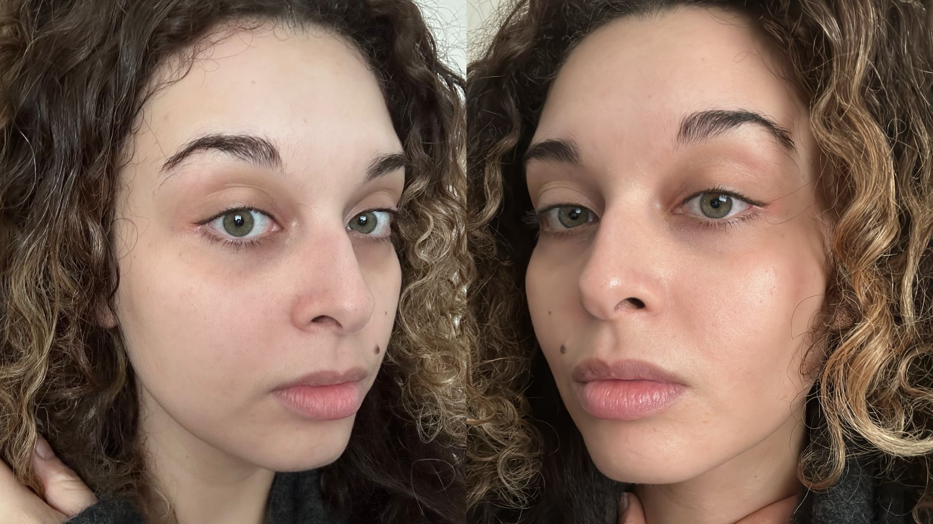 Ashlee before and after using Naturium Multi-Peptide Rich Cream | Space NK