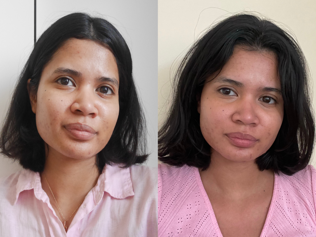 Before and after Medik8 Crystal Retinal 20 Serum | Space NK