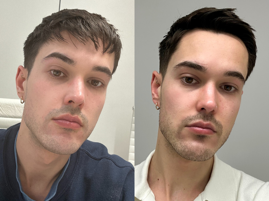 Before and after Charlotte Tilbury Magic Cream | Space NK Before and after Charlotte Tilbury Magic Cream | Space NK