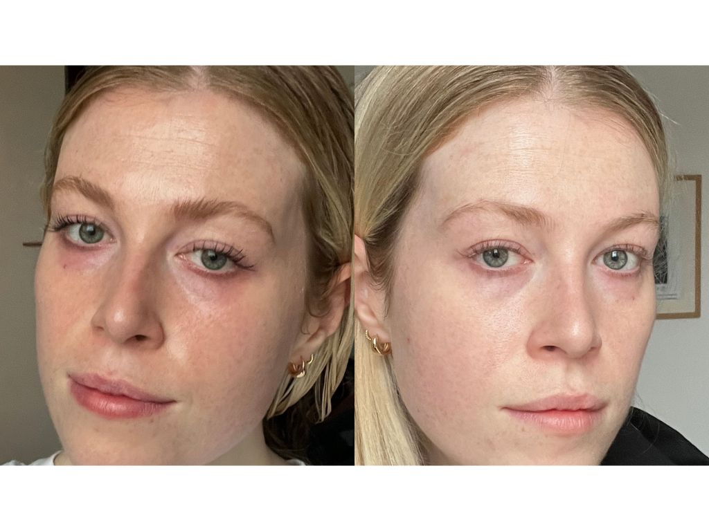 Eleanor before and after La Prairie | Space NK Eleanor before and after La Prairie | Space NK