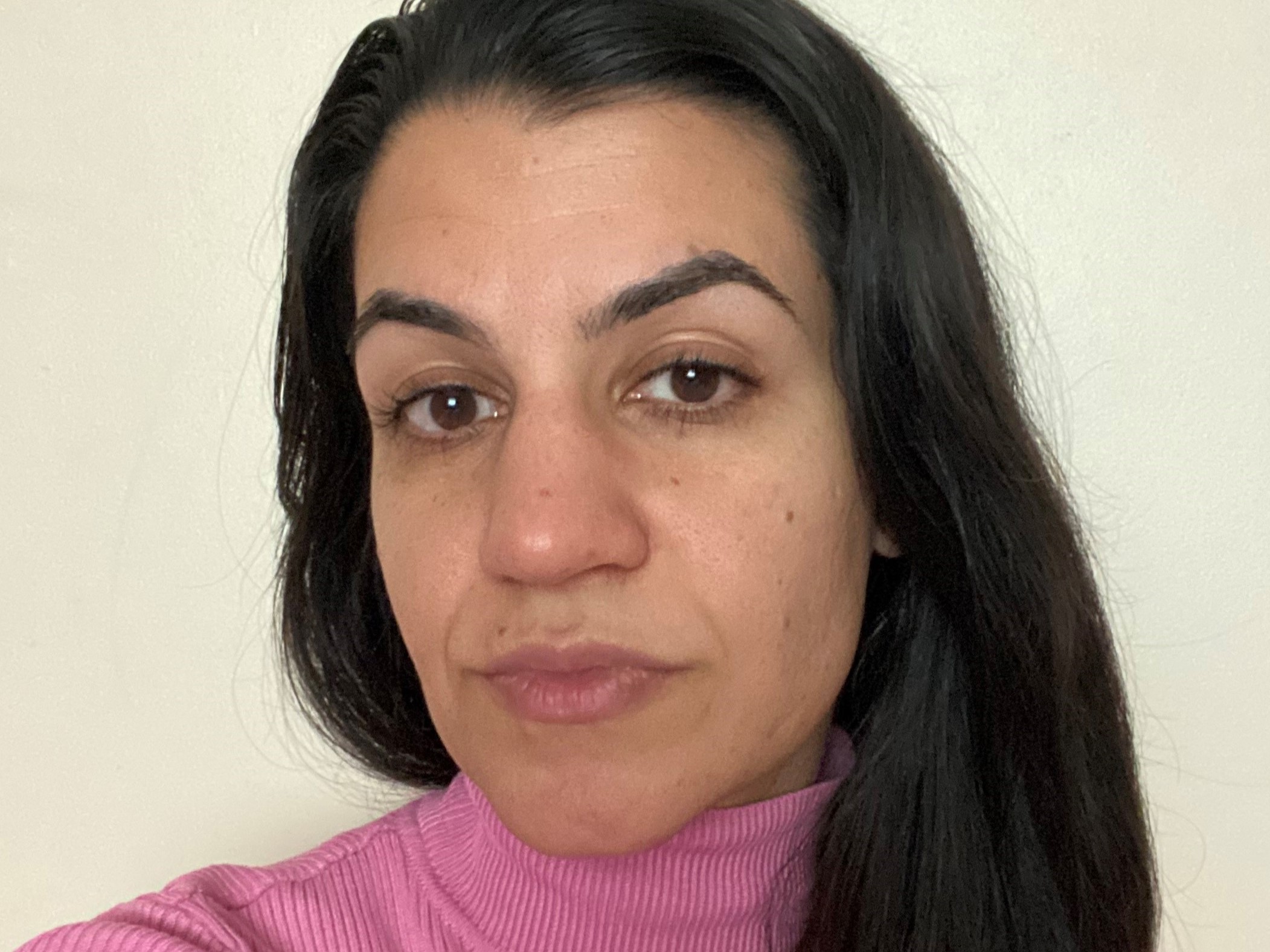 Sunday Riley B3 Nice Niacinamide Serum Before | Space NK Sunday Riley B3 Nice Niacinamide Serum Before | Space NK