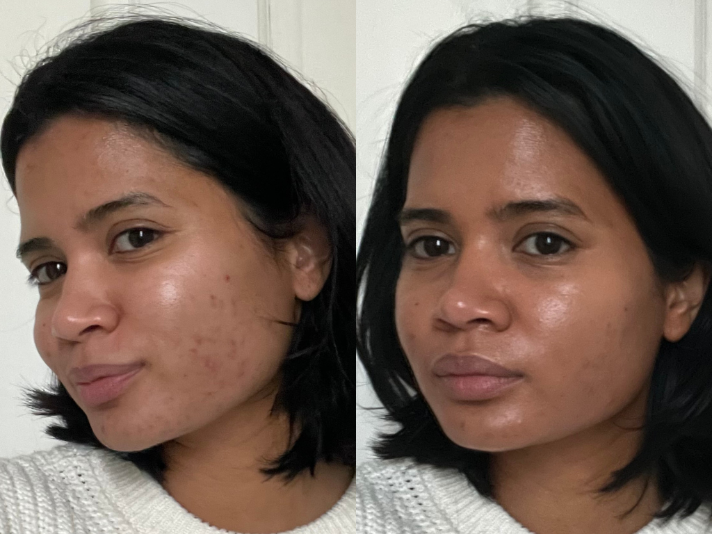 Hanitra's before and after Ilia Skin Tint | Space NK Hanitra's before and after Ilia Skin Tint | Space NK