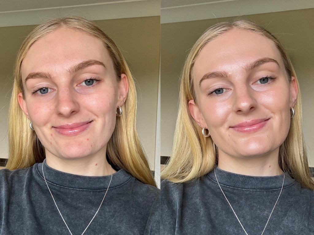 Before and after photos of Charlotte Tilbury Unreal Skin Foundation | Space NK Before and after photos of Charlotte Tilbury Unreal Skin Foundation | Space NK