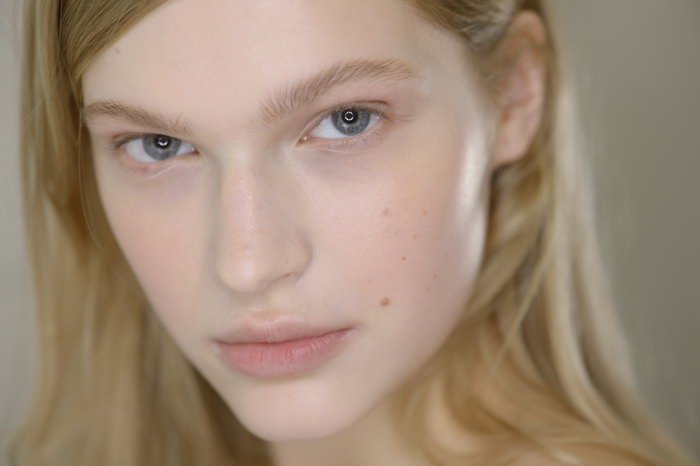 How To Reduce Acne Scarring