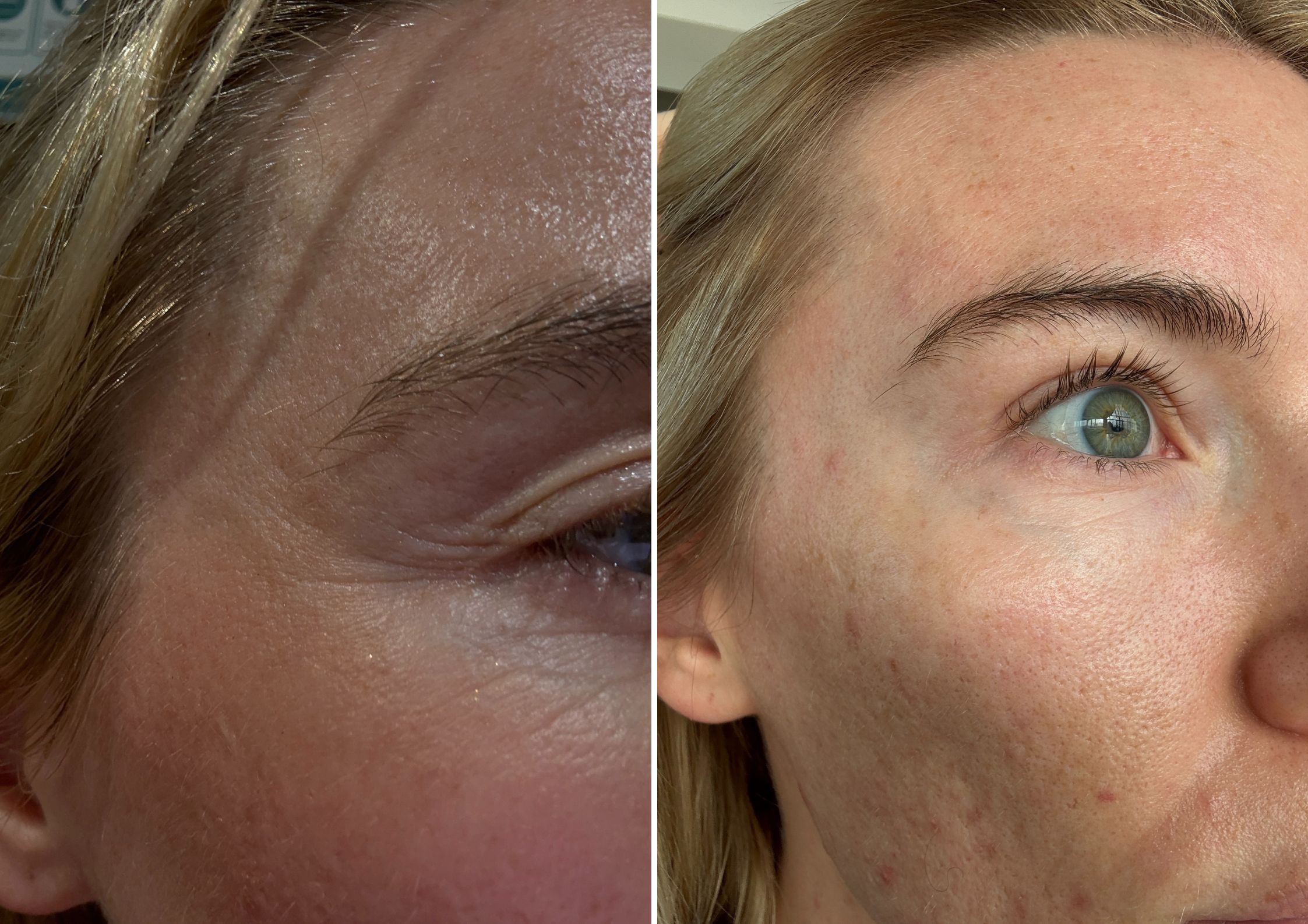 Georgia's Medik8 Advanced Pro-Collagen Peptide Cream Review 2 Georgia's Medik8 Advanced Pro-Collagen Peptide Cream Review 2