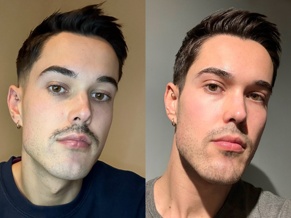 Before and after Skin Rocks The Rich Moisturiser | Space NK Before and after Skin Rocks The Rich Moisturiser | Space NK