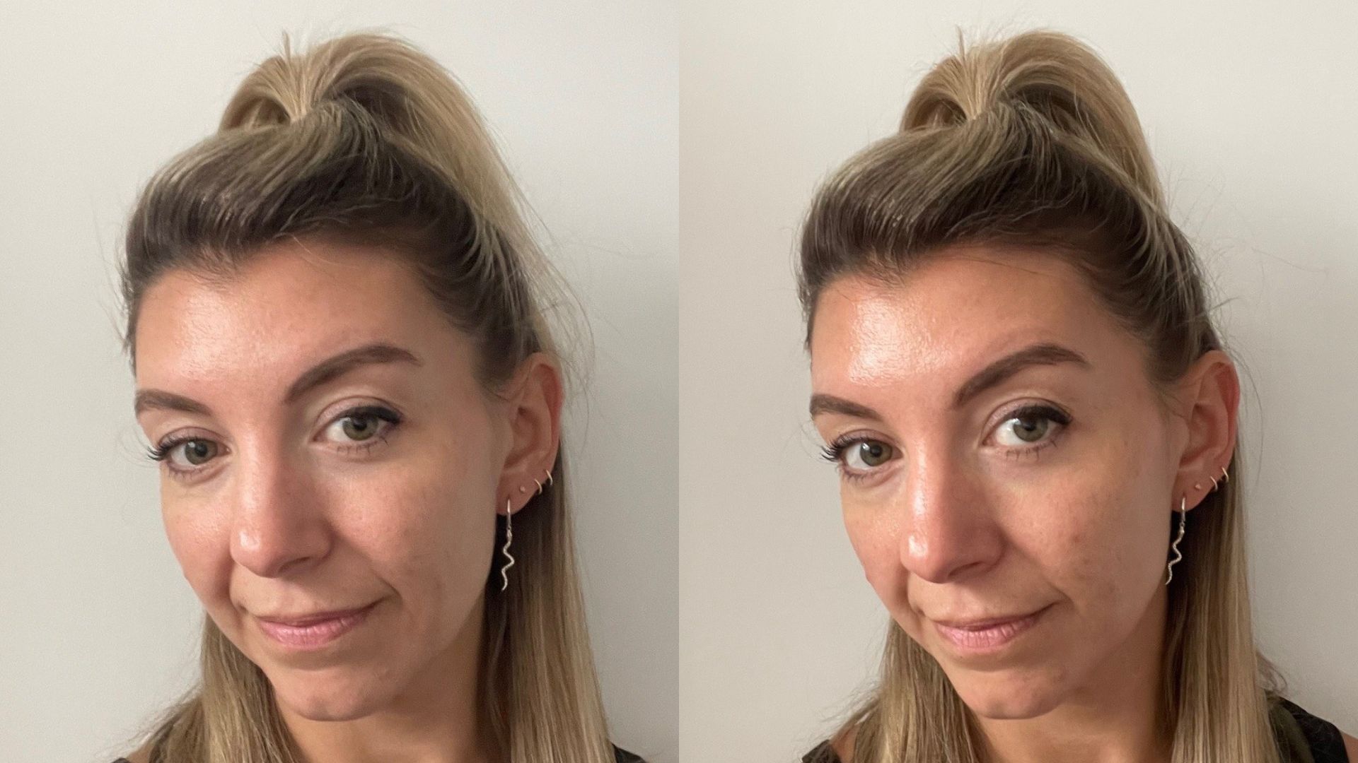 Becci before and after using Naturium Multi-Peptide Rich Cream | Space NK